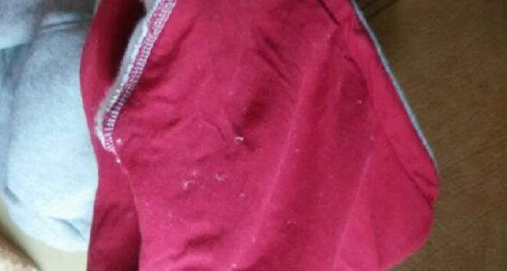 衣服掉毛怎么处理永久不掉毛_掉毛的衣服怎么处理