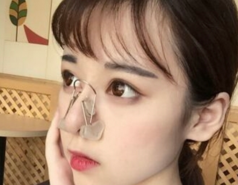 鼻梁特别塌怎么办，鼻梁塌怎么办