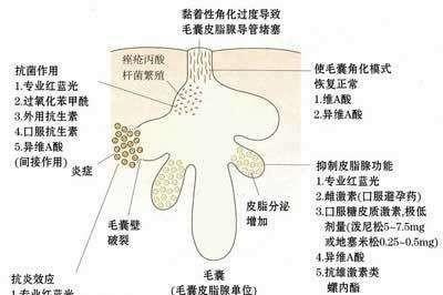 脸上都是痘痘怎么快速消除 痘痘严重怎么办