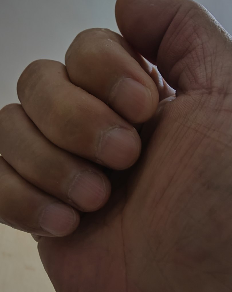 手机掉厕所怎么处理_手机掉厕所里怎么捞上来