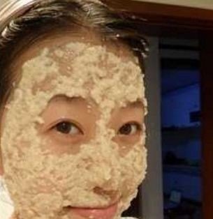 脸上有黑斑怎么治疗_怎么消除脸上黑色斑点