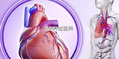 冠心病一般是什么原因引起的