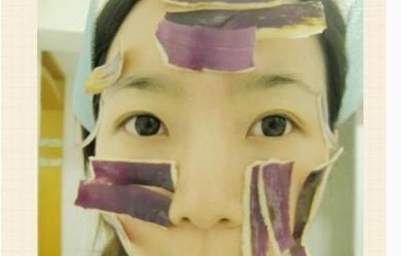 脸上有黑点怎么去掉