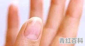指甲没有“月牙”，是怎么回事？能找回“月牙”吗