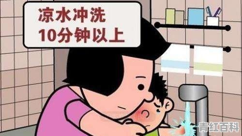 一岁宝宝烫伤怎么办抹什么
