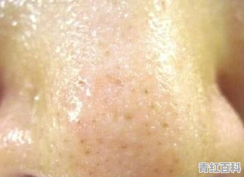 脸发干、起皮屑，该怎么护肤