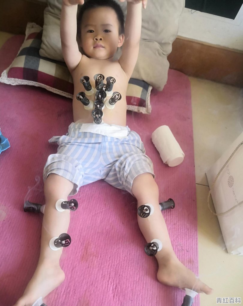 小孩脾虚怎么调理