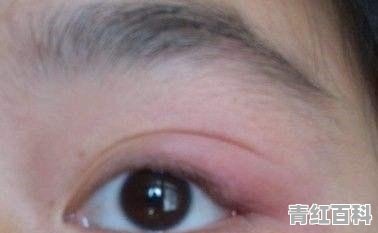 我家的巴西龟眼睛肿起，里面还有好多水水，要怎么搞