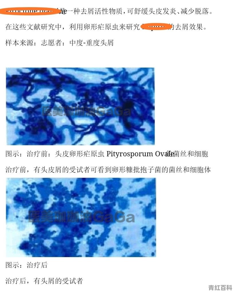 长时间不洗头头油可以滋润头发吗