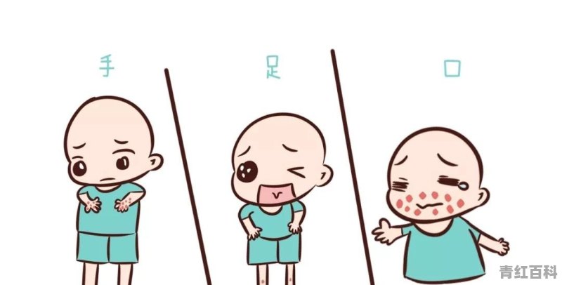 小孩手足口病怎么办?
