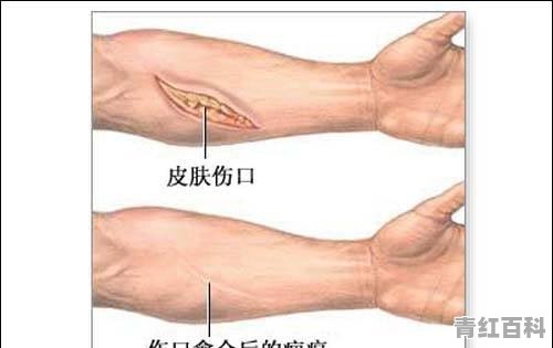皮肤干燥起皮红肿怎么办