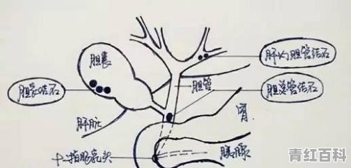 眼睛黄，脸黄是怎么回事