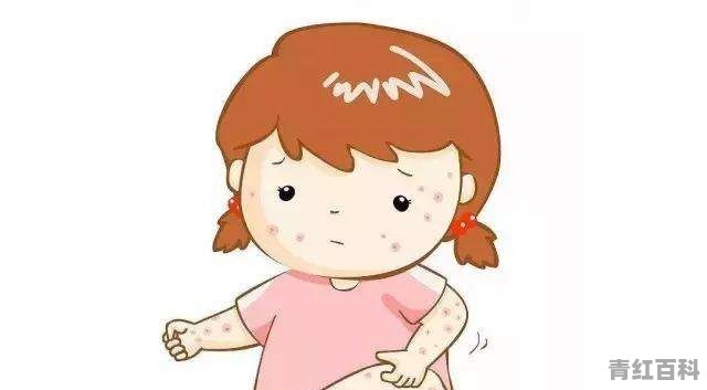 身上起热痱子怎么办