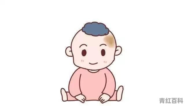 孩子身上各种颜色的胎记都需要治疗吗