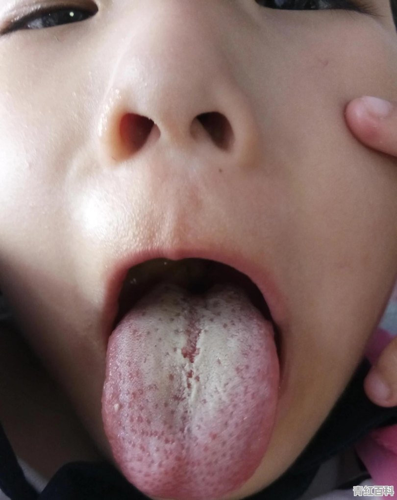 宝宝胀气便秘怎么办快速排气