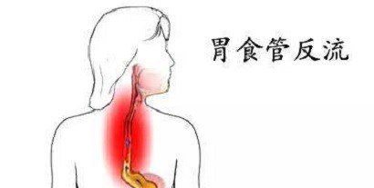 胃不舒服反酸怎么办?
