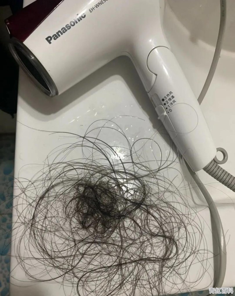 掉头发怎么办