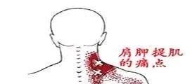 胳膊筋疼怎么治