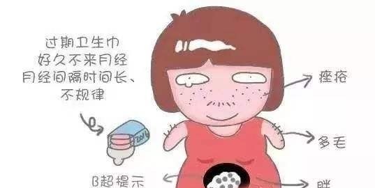多囊卵巢综合征是什么病？为什么越来越多的女性得这种病，是一种肿瘤吗
