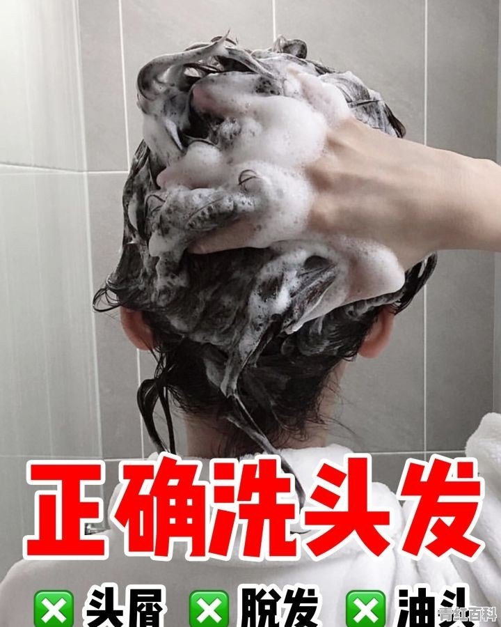 头皮屑多导致的脱发要怎么治疗