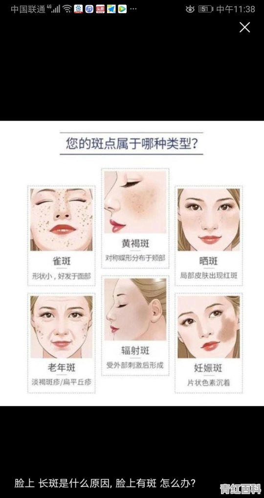 脸上斑点多怎么办怎么去掉脸上的斑点