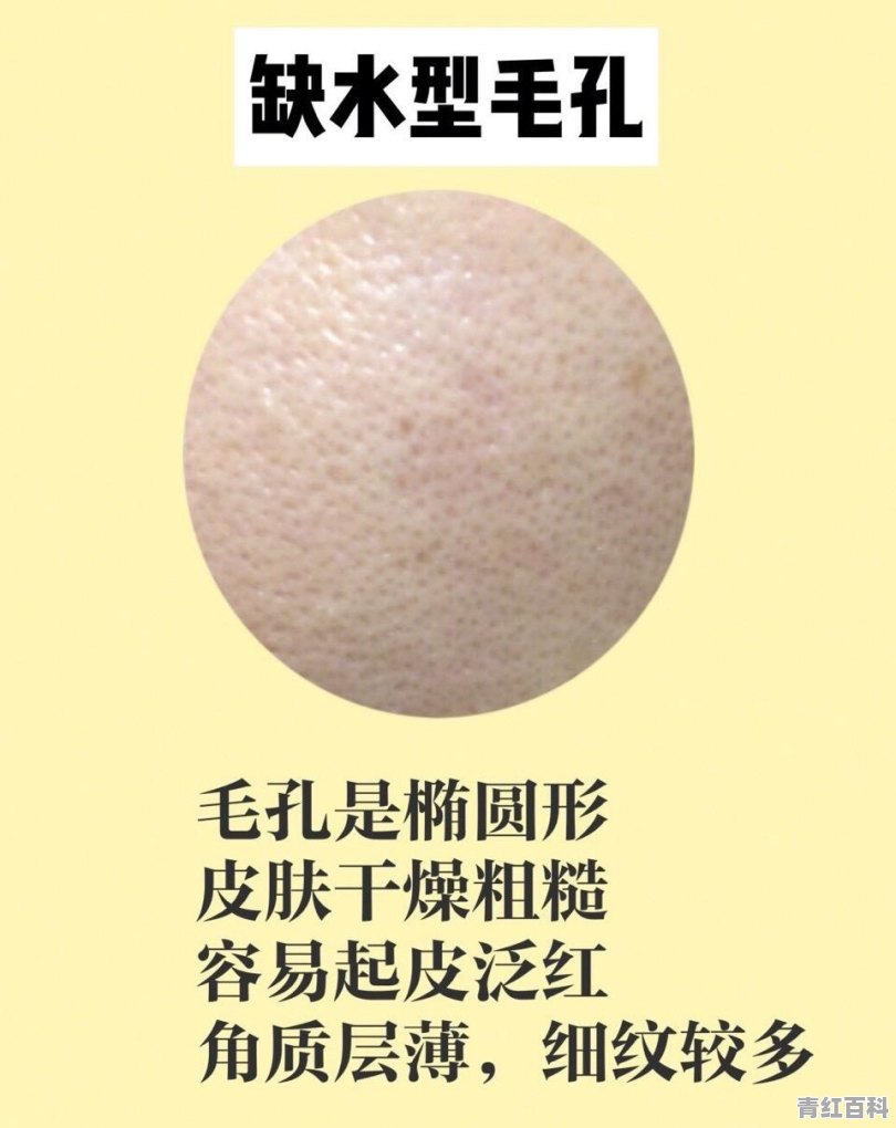 毛孔堵塞长痘怎么办?