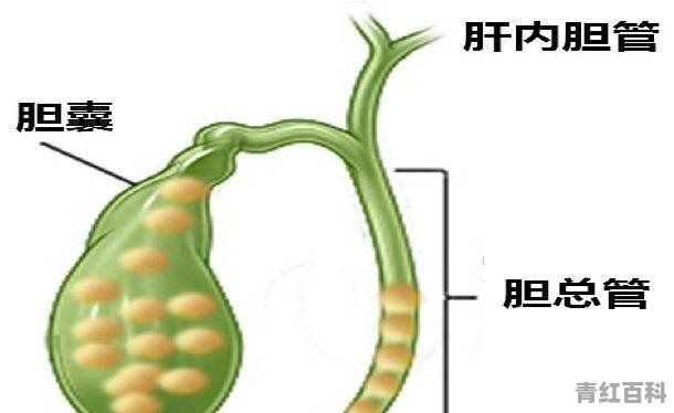 肝管结石怎么办才能排出