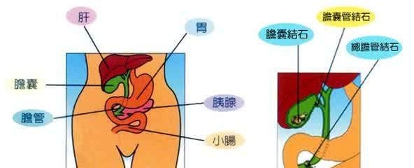 孕妇胆囊炎怎么办,对宝宝有影响吗
