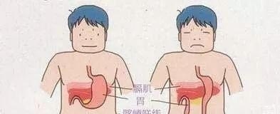 胃下垂如何调养呢