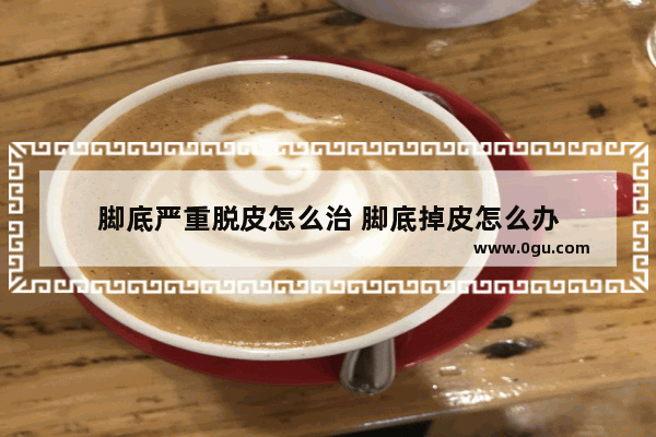 脚底严重脱皮怎么治 脚底掉皮怎么办