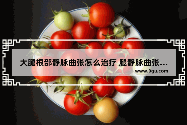 大腿根部静脉曲张怎么治疗 腿静脉曲张怎么办