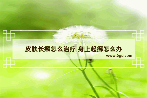 皮肤长癣怎么治疗 身上起癣怎么办