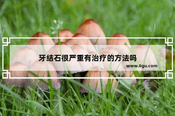 牙结石很严重有治疗的方法吗