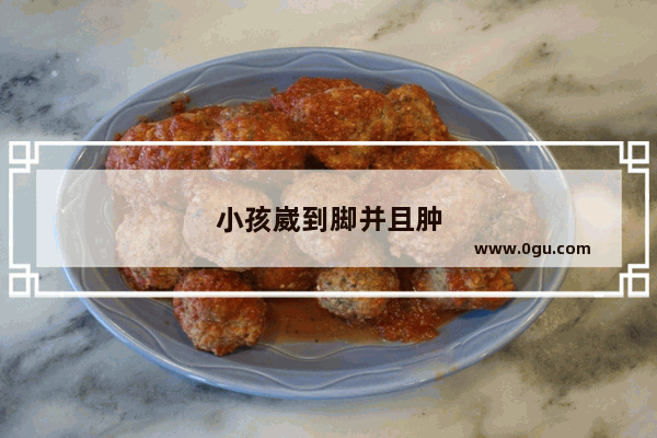 小孩崴到脚并且肿