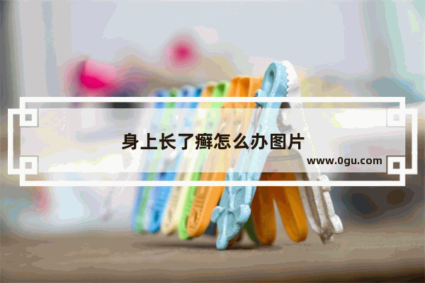 身上长了癣怎么办图片