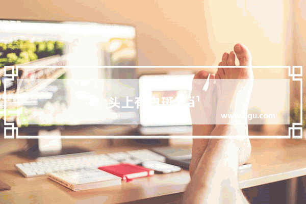 头上有白斑怎么办?